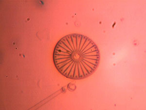 Diatom with Cheap Microscope
