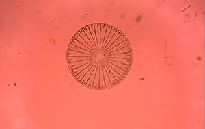 Diatom with Cheap Microscope