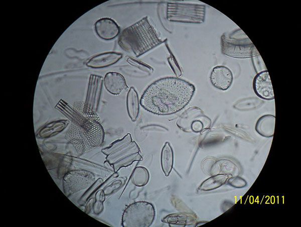 Diatom with Cheap Microscope