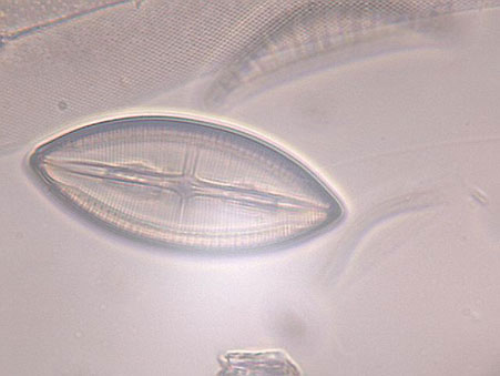 Mixed Diatoms 40x